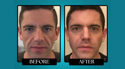 Morge™ Anti-Wrinkle Balm